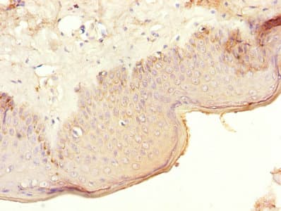 Polyclonal Rabbit anti-Human CRFR1 / CRHR1 Antibody (WB)