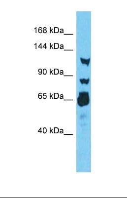 Polyclonal Rabbit anti-Human RNF213 Antibody (aa893-942, IHC, WB)