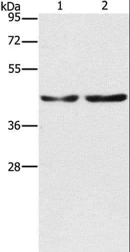CBX6 Antibody