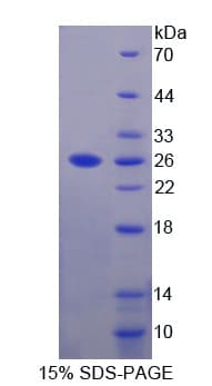 Mouse DSPG3 / Epiphycan Protein (Recombinant His-T7)
