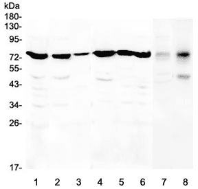 CHM / REP1 Antibody