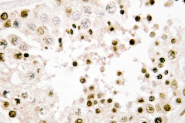 NBN / Nibrin Antibody (Pro461)