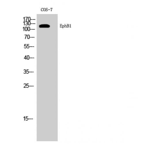 EPHB1 / EPH Receptor B1 Antibody (810-890 aa, C-terminal)