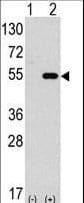 Polyclonal Rabbit anti-Human AUTL1 / ATG4C Antibody (aa167-196, IHC, WB)
