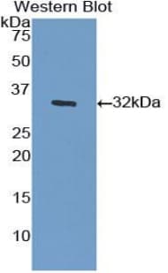 Polyclonal Rabbit anti-Human IGF2R / CD222 Antibody (aa2167-2442, WB)