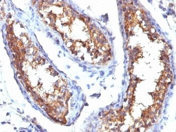 CD99 Antibody (clone HO36-1.1, Ready-to-Use)