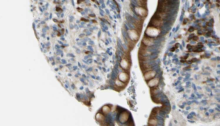 GJB2 / CX26 / Connexin 26 Antibody