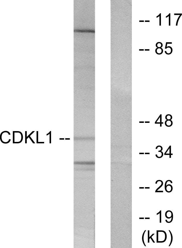 CDKL1 Antibody