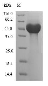 Human ARL6 Protein (Recombinant GST, N-terminus)