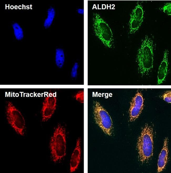 Monoclonal Mouse anti-Human ALDH2 Antibody (clone 4G6A3, Amino Acid: 317-517, IHC, IF, WB)