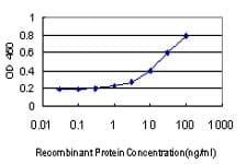 Monoclonal Mouse anti-Human COL4A6 / Collagen IV Antibody (clone 1G11)