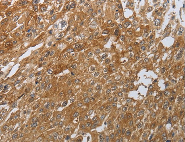 PTPRM / PTP Mu Antibody
