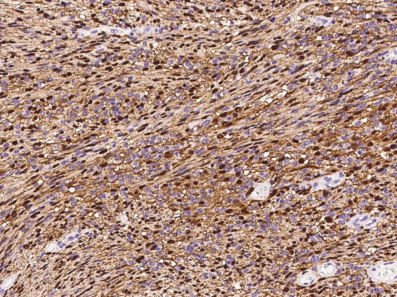 S100B / S100 Beta Antibody (clone 30, Preservative Free)
