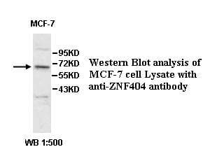 Polyclonal Rabbit anti-Human ZNF404 Antibody (aa63-314, IHC, WB)