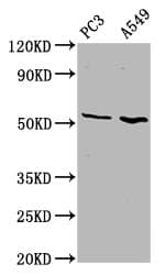 ETV5 / ERM Antibody