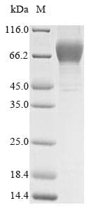 Human GUCY2C / Guanylyl Cyclase C Protein (Recombinant 10His, N-terminus)