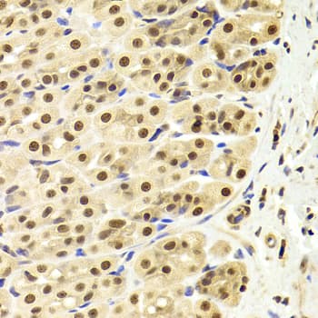 PPP1R8 / Rnase E Antibody