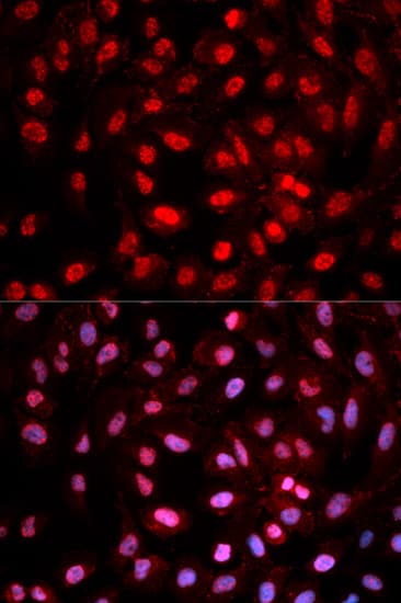 DNMT / DNMT1 Antibody (phospho-Tyr399)