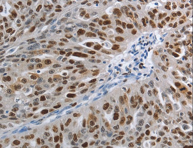 MCM3 Antibody
