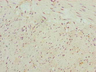 NBPF3 Antibody