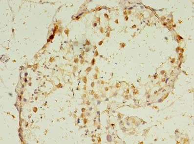 Polyclonal Rabbit anti-Human Geminin Antibody (IHC)