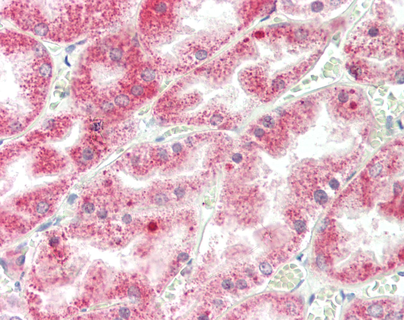 IHC-plus™ CASR/Calcium Sensing Receptor Antibody