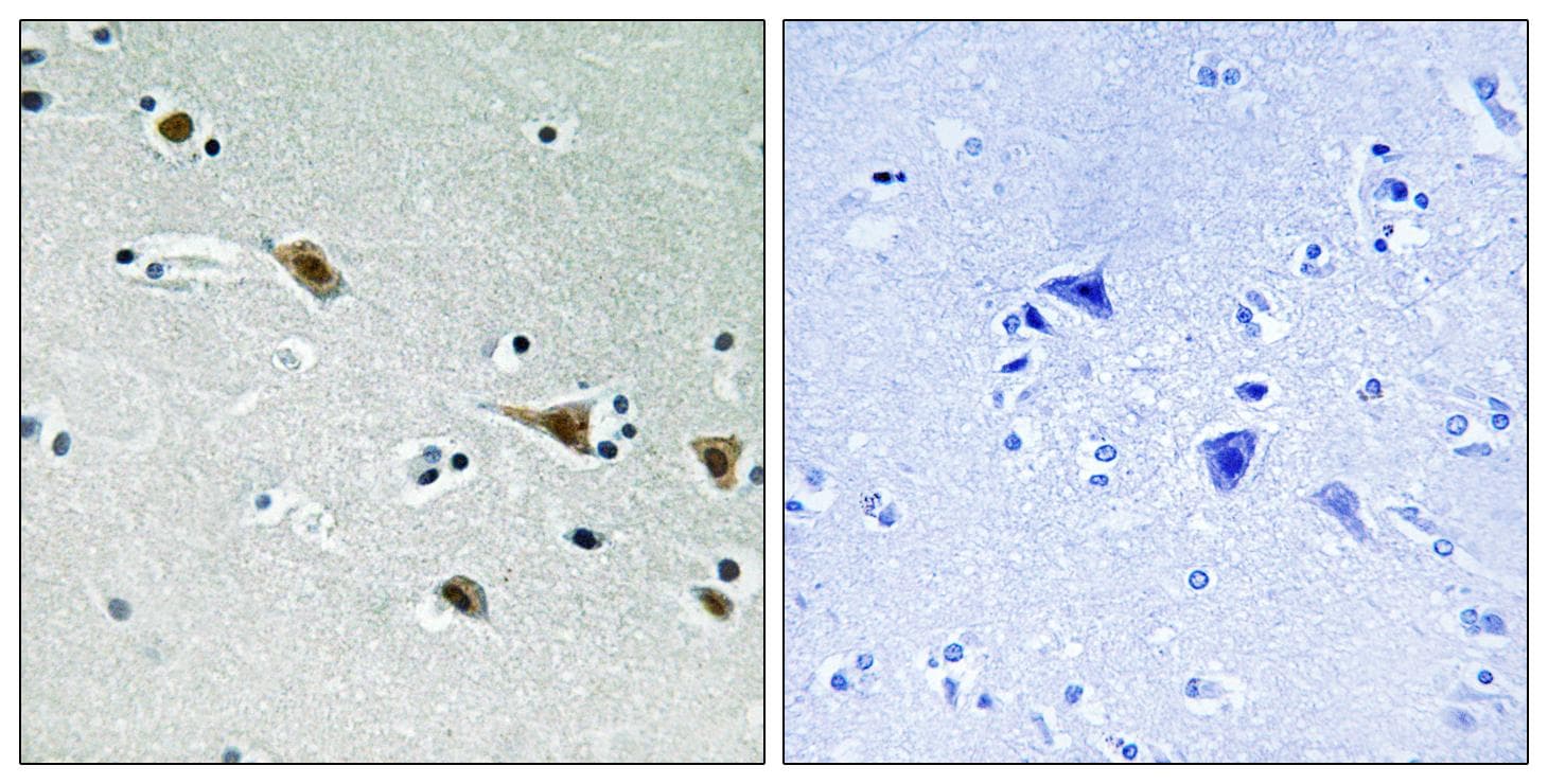 MAP2K7 / MEK7 Antibody (phospho-Ser271)