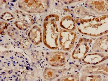 Polyclonal Rabbit anti-Human RAD9A / RAD9 Antibody (IHC)