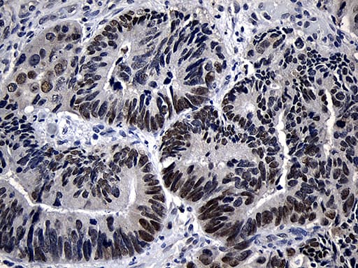 Monoclonal Mouse anti-Human ZKSCAN1 / ZNF36 Antibody (clone OTI2C9, Carrier-free, IHC, WB)