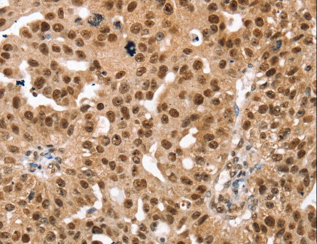 Polyclonal Rabbit anti-Human SMARCB1 / INI1 Antibody (IHC, WB)