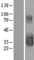 C20orf103 Protein (Over-Expression Lysate Myc-DDK (Flag))
