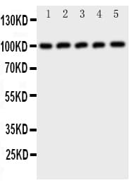 c-CBL Antibody (aa863-877)