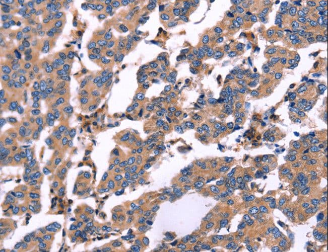 RDX / Radixin Antibody