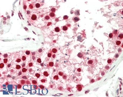 IHC-plus™ TP53BP1 / 53BP1 Antibody (aa350-400)