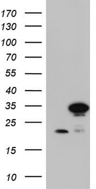 LGALS3 / Galectin 3 Antibody (clone OTI23D12)