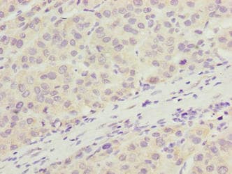 ARMT1 Antibody