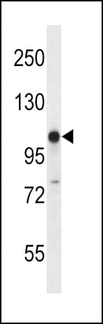 Polyclonal Rabbit anti-Human GRIK3 / GLUR7 Antibody (aa70-98, IHC, WB)