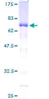 Human MEIS2 Protein (Recombinant GST)