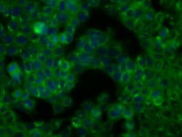BTK Antibody (clone OTI3A2)