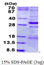 Human NDUFS3 Protein (Recombinant His)
