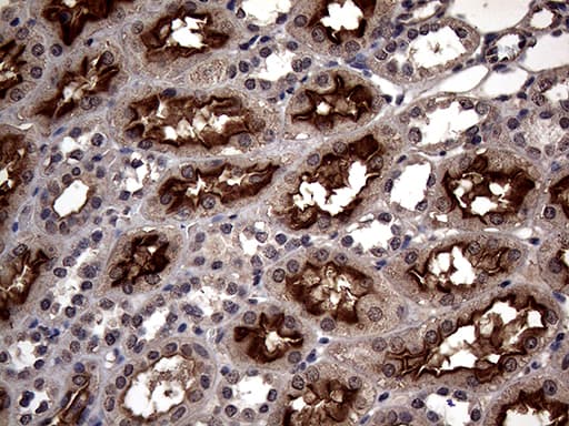 ABCB1 / MDR1 / P Glycoprotein Antibody (aa995-1280, clone OTI9C10)