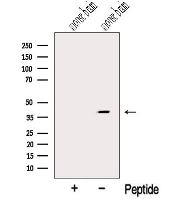 NUDT9 Antibody