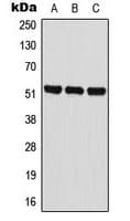 Polyclonal Rabbit anti-Human BAIAP2L2 Antibody (Internal, IHC, WB)