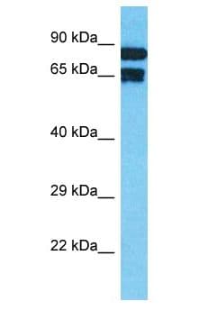 TNFAIP2 Antibody (aa25-74)