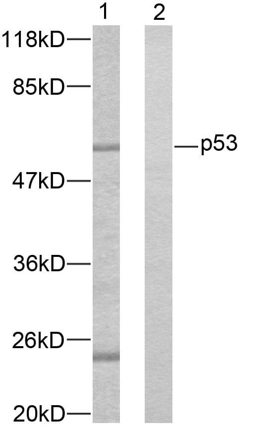 Polyclonal Rabbit anti-Human TP53 / p53 Antibody (aa11-60, WB)