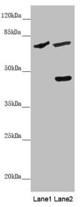 SLC39A4 / ZIP4 Antibody