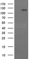FAK / Focal Adhesion Kinase Antibody (clone OTI4G7)