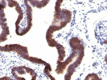 EPCAM Antibody (clone EGP40/1120)