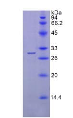 Human SGPL1 Protein (Recombinant His)