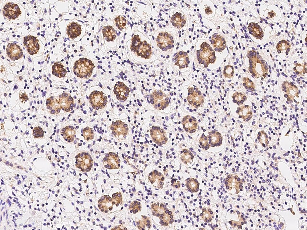 Polyclonal Rabbit anti-Human TIP30 / HTATIP2 Antibody (IHC, WB)